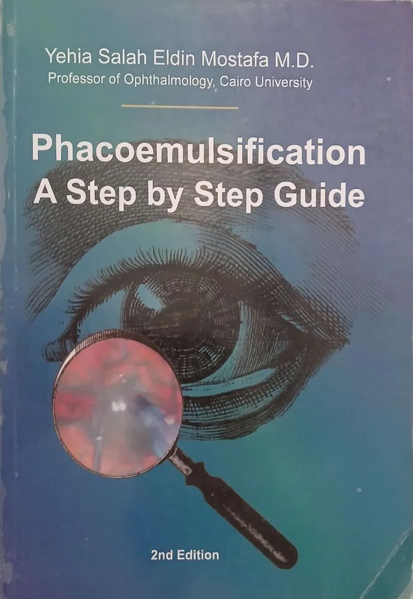  Phacoemulsification — A Step by Step Guide